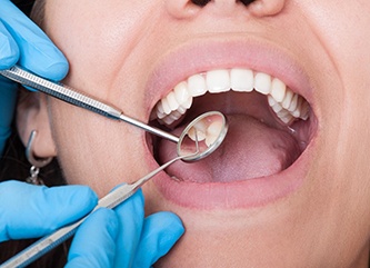 Closeup of woman’s teeth being examined by dentist in blue gloves